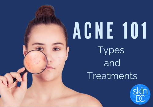 acne types treatments aviclear cystic acne