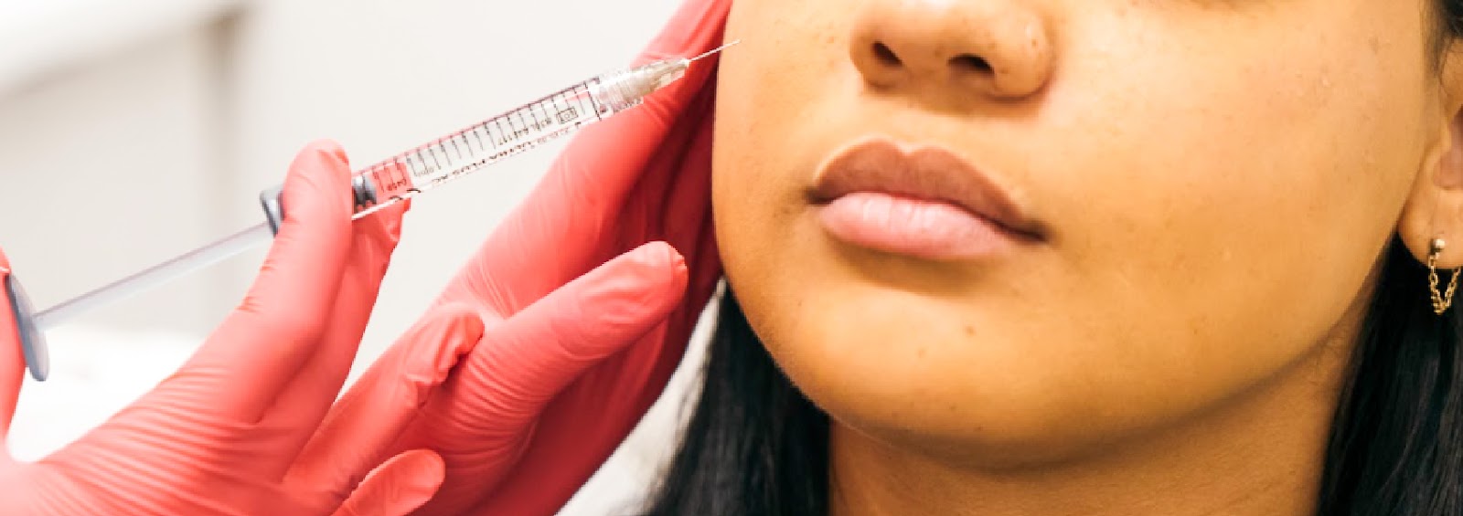 SkinDC’s Guide to Dermal Fillers