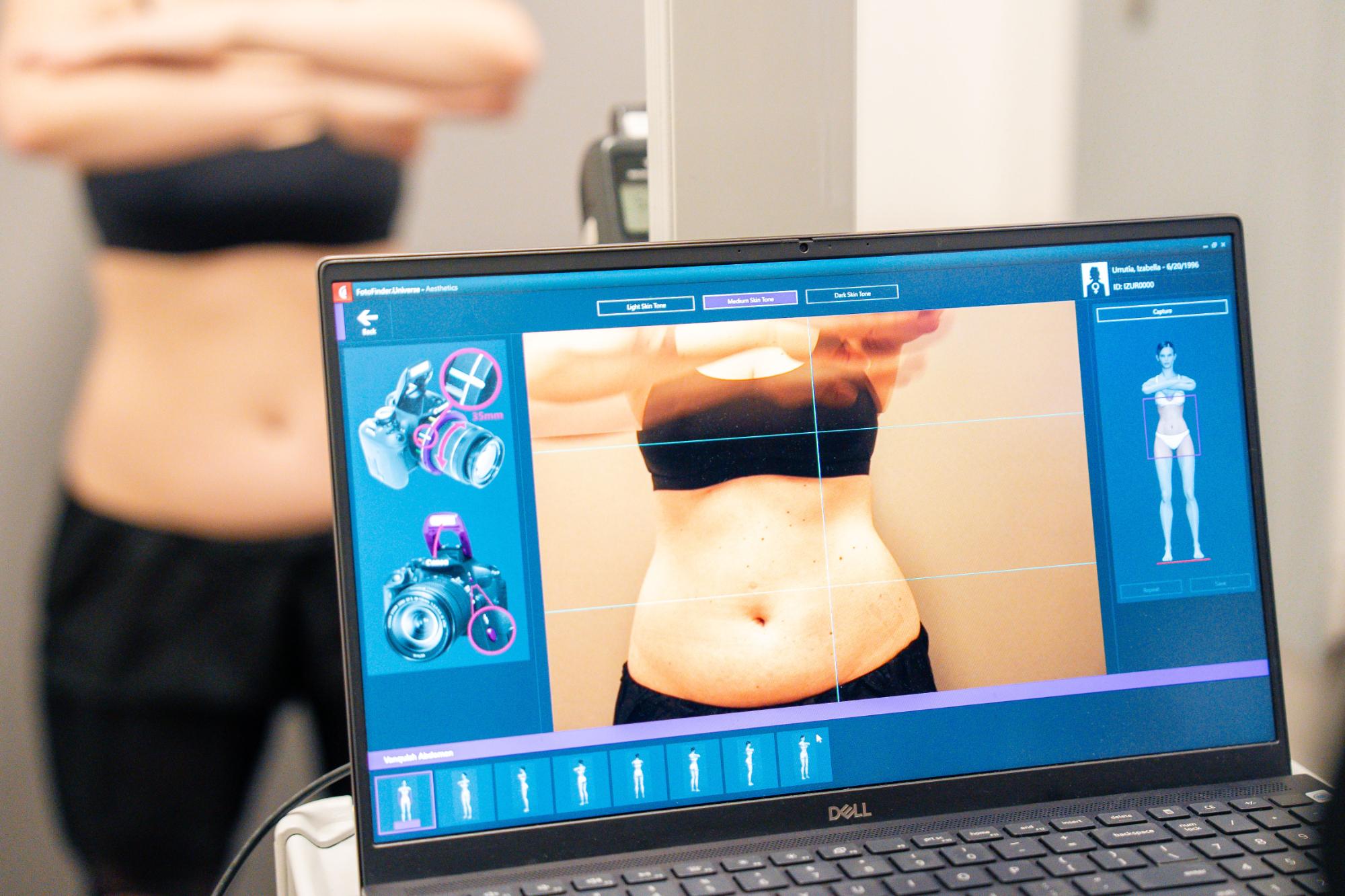 skindc-patient-int-02131 skindc-patient-int-02131